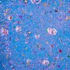 Microplastics image